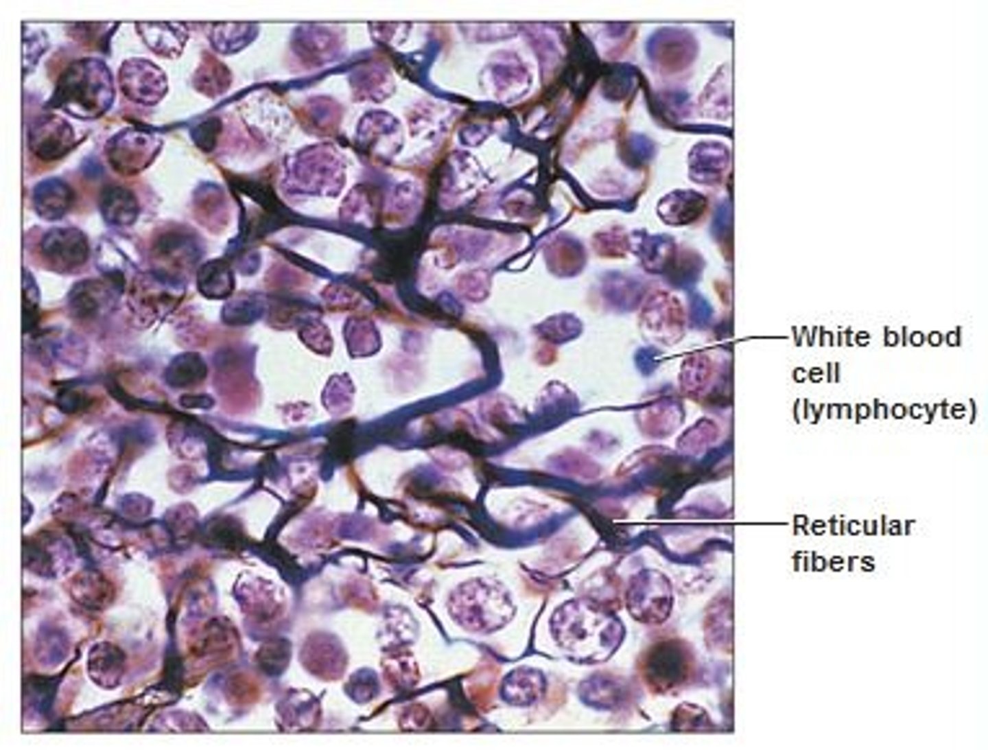 <p>Resembles areolar tissue but the matrix is made up of only reticular fibers.</p><p>Found in bone marrow, spleen, liver, and lymph nodes</p><p>Function: forms storma of organs, binds together smooth muscle, filters and removes worn out blood cells in spleen</p><p>Made up of: fine interlacing network of reticular fibers</p>