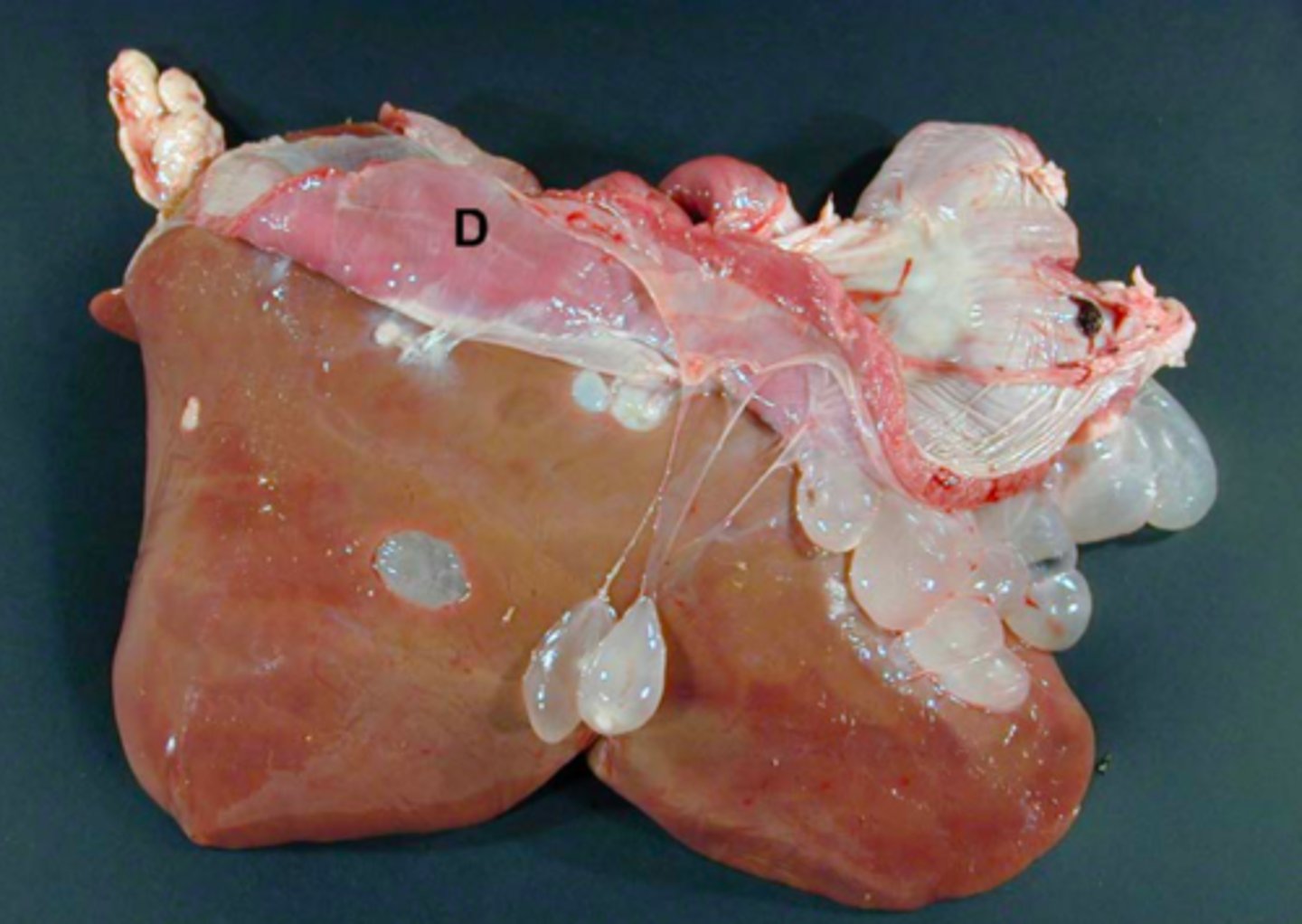 <p>Lever fra får (med diaphragma, D), hvad er den patoanatomiske diagnose og ætiologien?</p>