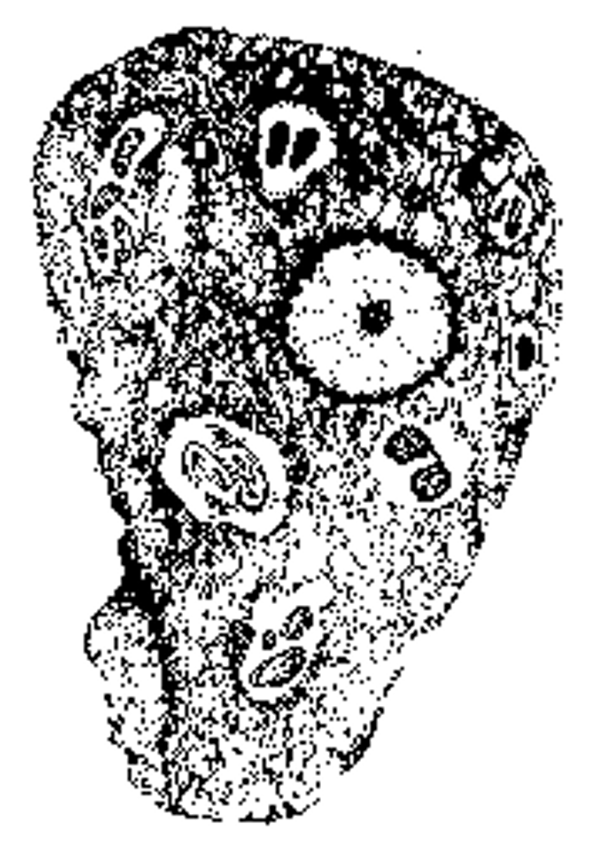 <p>I reside in the mouth where I measure approximately 17 micro meters.</p><p>A. Entamoeba coli trophozoite</p><p>B. Entamoeba gingivalis trophozoite</p><p>C. Acanthamoeba species trophozoite</p><p>D. Trichomonas vaginalis trophozoite</p>