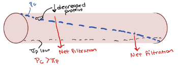 → Net filtration occurs through whole vessel thus ↓fluid in blood and it accumulates in tissue
