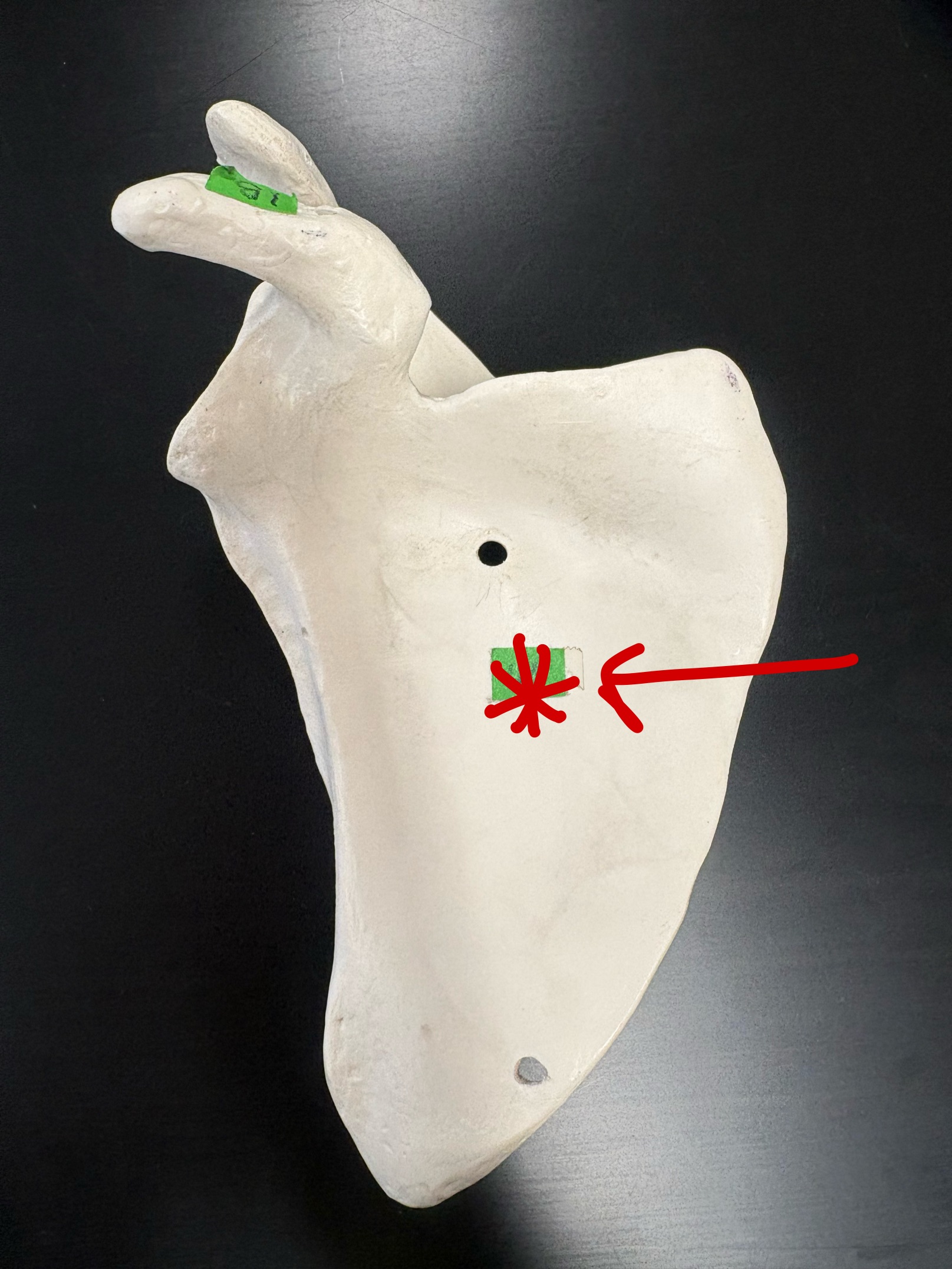 <p>Name this structure</p>