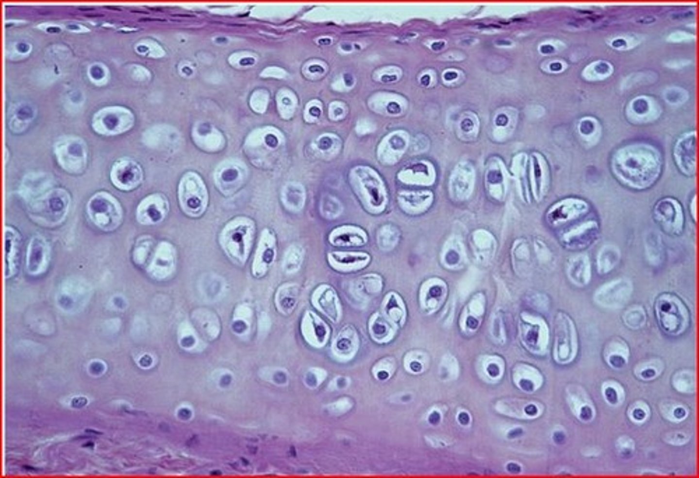 <p>- amorphous but firm matrix</p><p>- chondrocytes made in matrix and lie in lacuna when theyre mature</p>