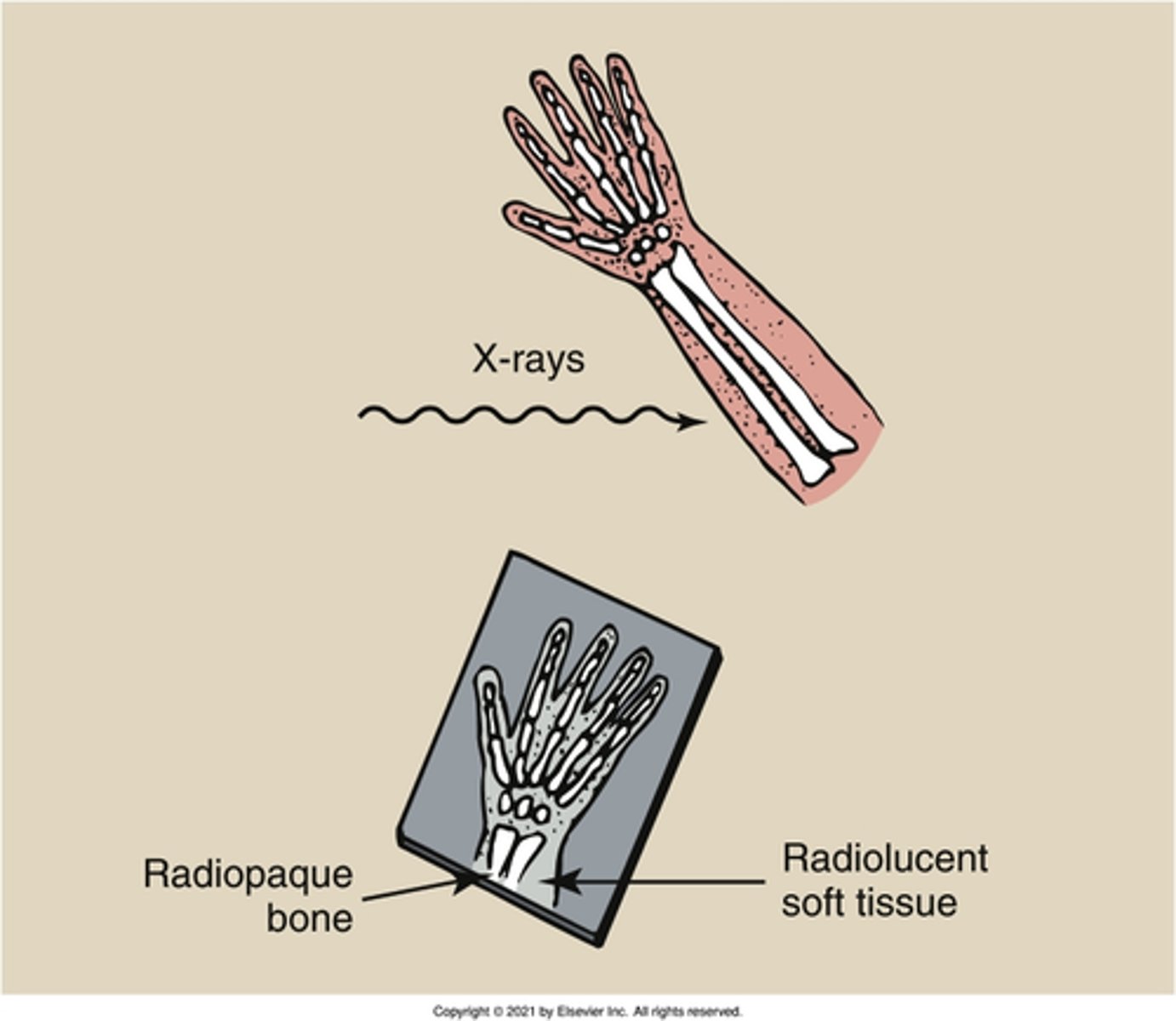 <p>What is the property of a substance that does not allow X-rays to pass through?</p>