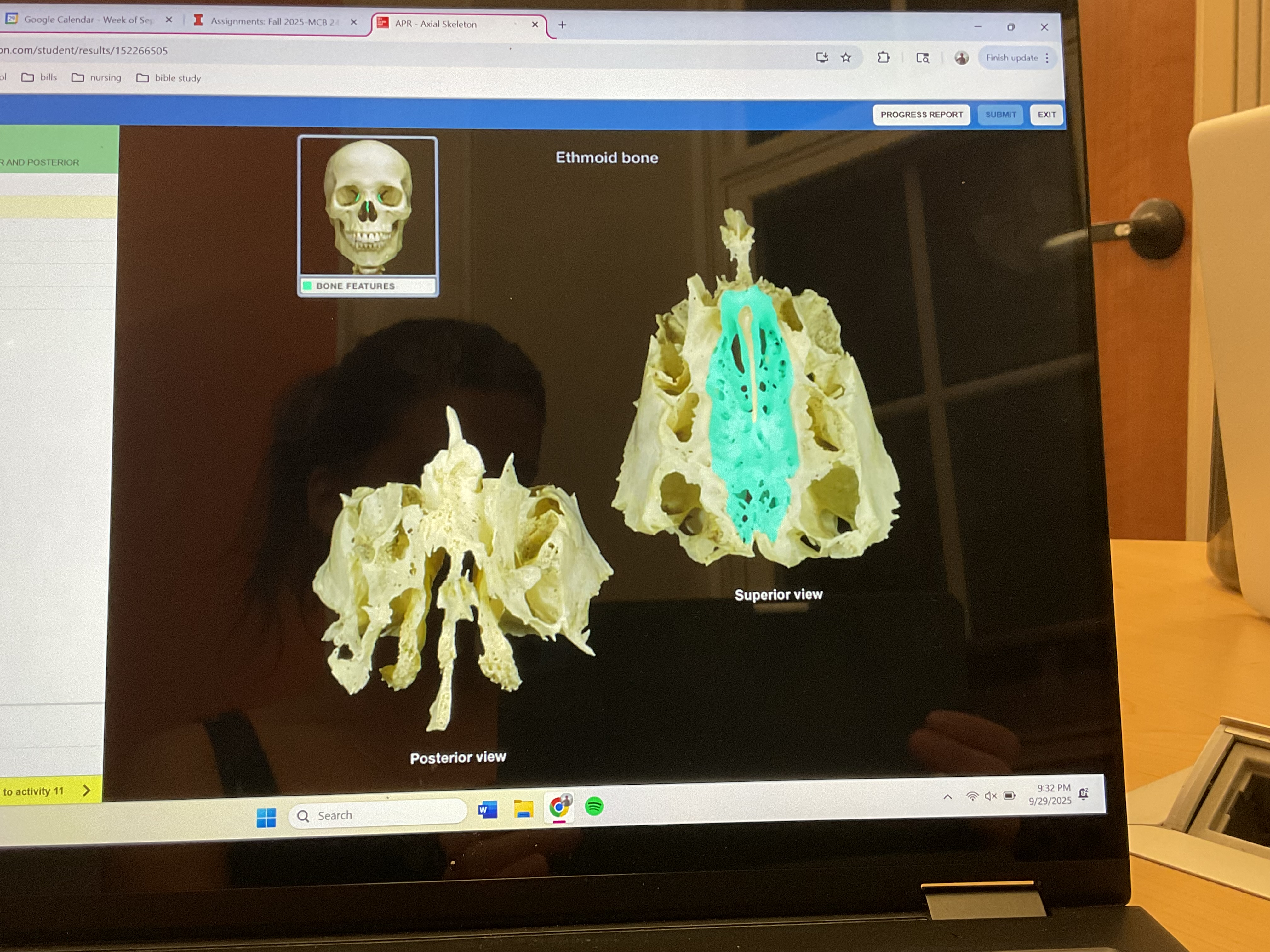<p>Cribiform plate </p>