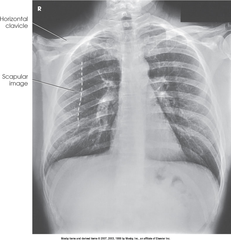 <p>What position is demonstrated?</p>
