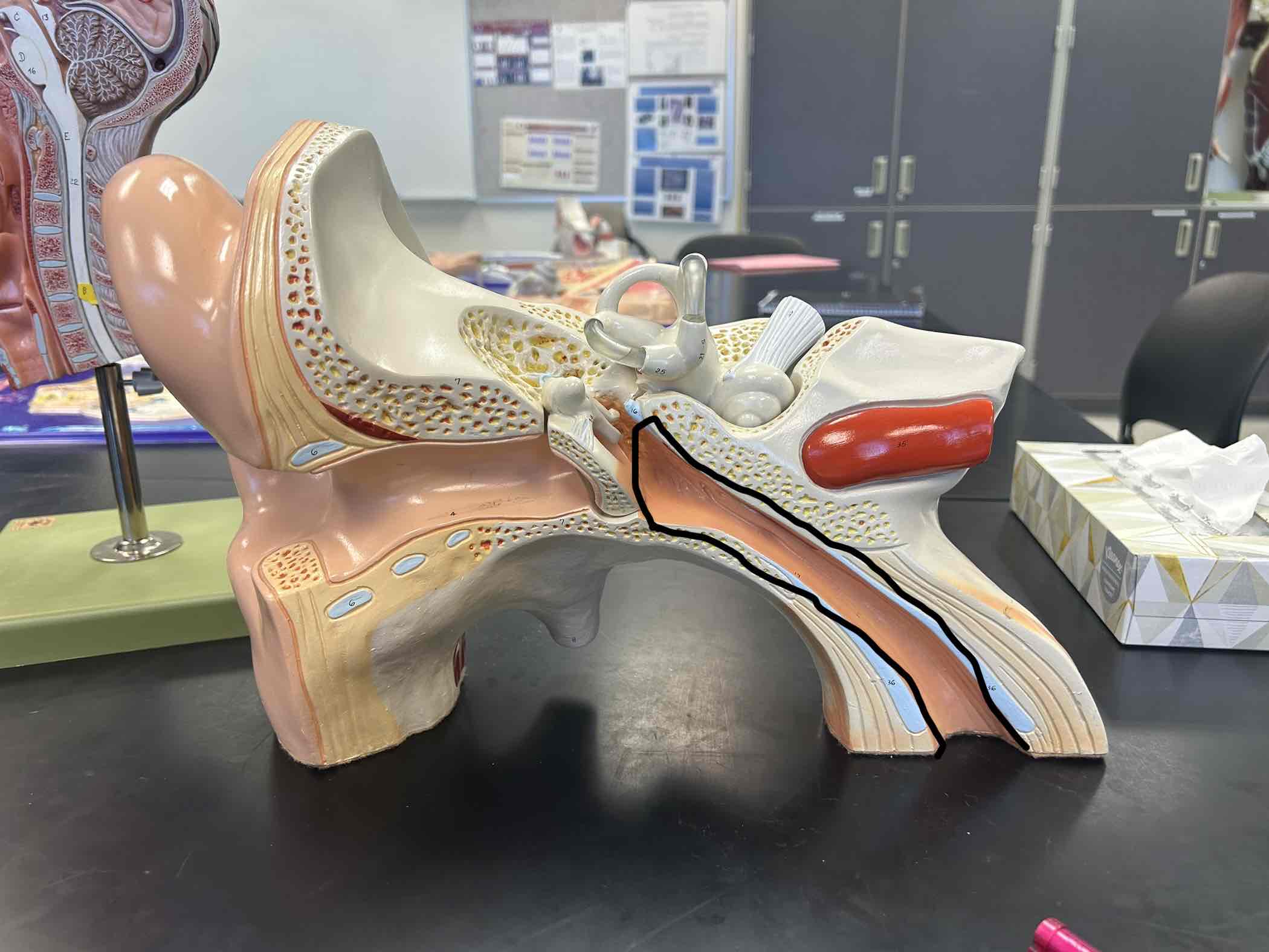 <p>Medial to the tympanic cavity</p>
