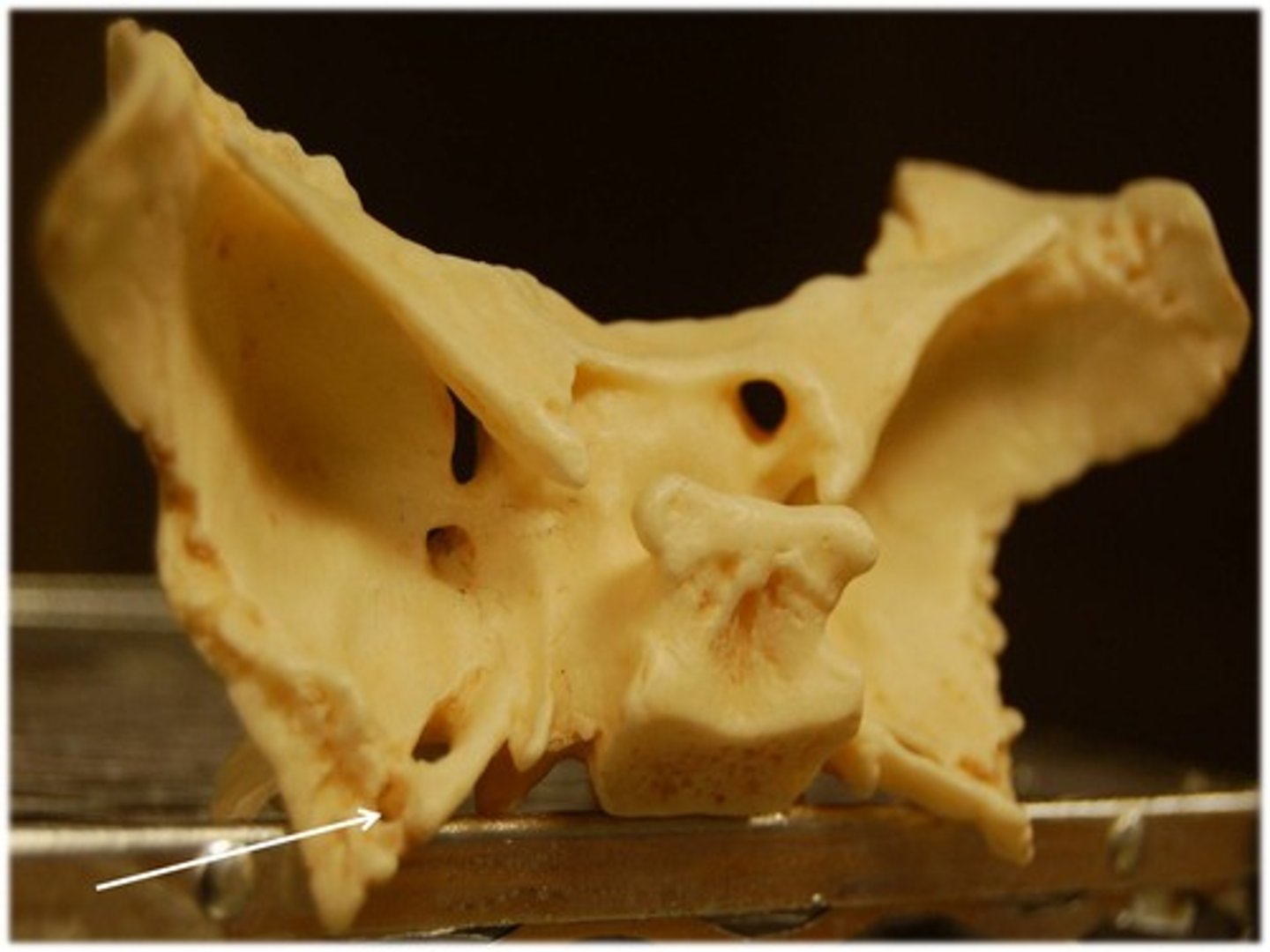 <p>Located on each greater wing just posterolateral to the foramen ovale</p>