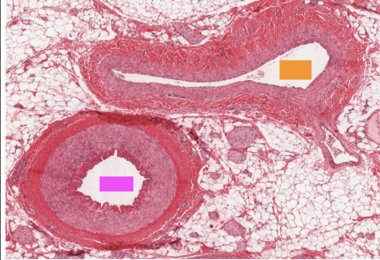 <p>Is the lumen with the PINK block an artery or vein?</p>