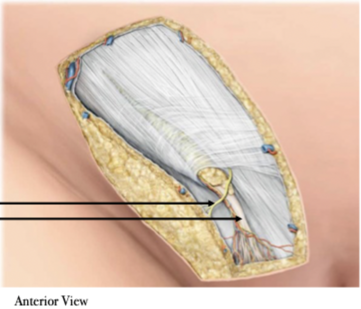 <p>Inguinal Canal - Females</p>