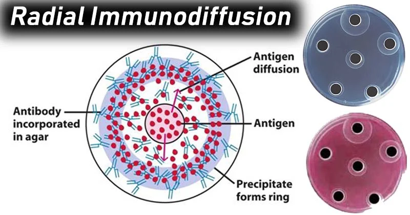 <p>radial immunodiffusion (aka single immunodiffusion) (RID) steps</p>