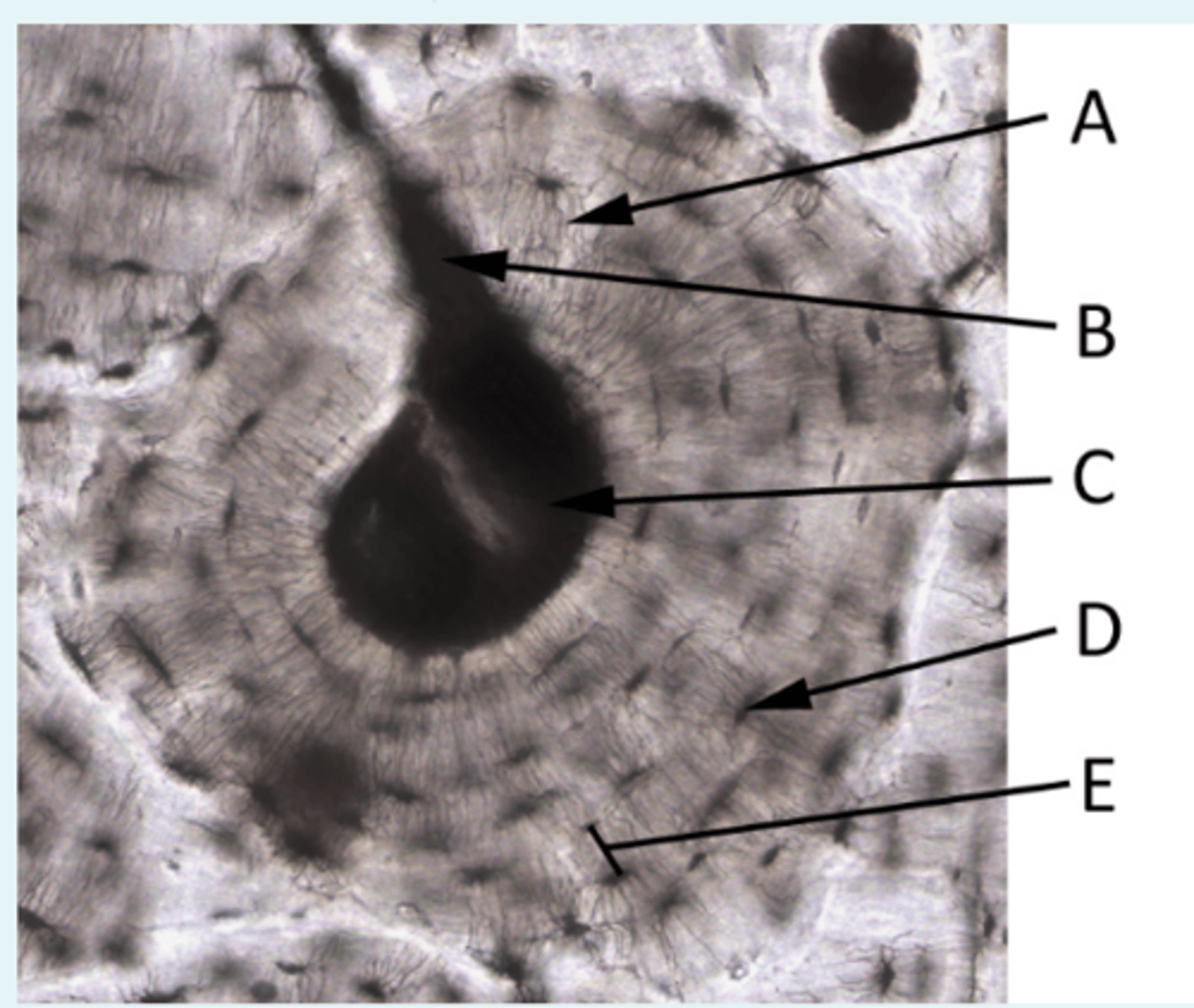 <p>In the following diagram of ground bone, which letters indicate a feature that provides channels for osteocyte communication?</p>