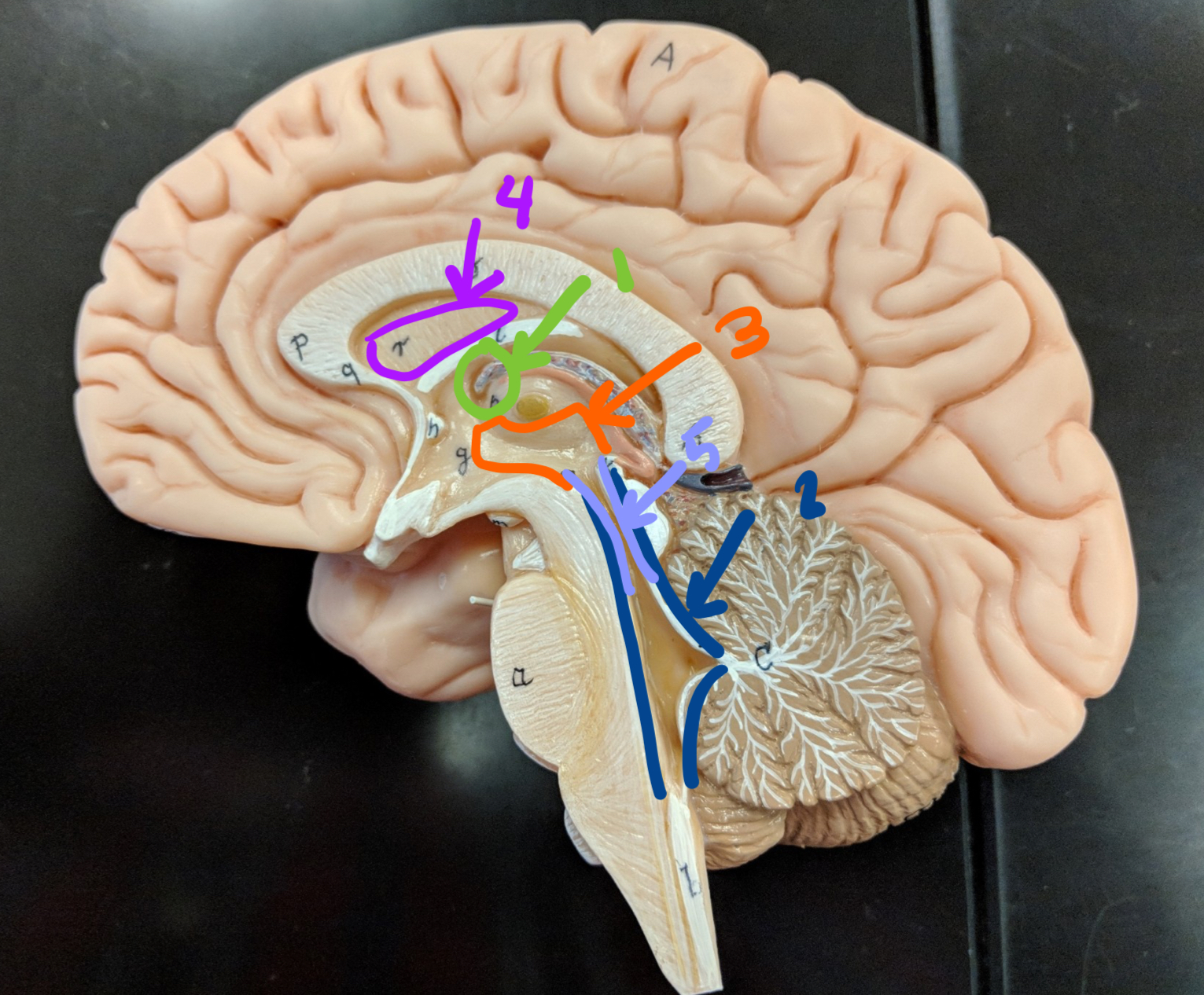 <p><strong>open spaces of the brain + the spine</strong></p><p>what structure is at 1?</p>