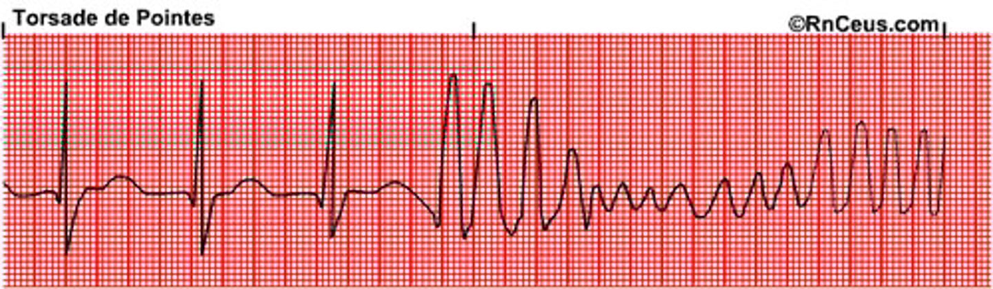 <p>Flutter 250-350</p><p>- type of vtach, can lead to vfib</p><p>- ribbon like fashion (hallmark: up and downward deflection of QRS)</p><p>- d.t hypomagnesium</p>