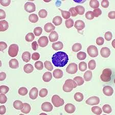 <p><strong>Name</strong>: Basophil (Granulocyte)</p><p><strong>Percent</strong>: &lt;1%</p><p><strong>Function</strong>:&nbsp;activate other WBCs and parasitic worms</p><p>releases histamines (causes inflammation)</p><p>plays role in allergies &amp; asthma</p><p>live span- several days</p><p>☆☆<span style="color: red;">Grainy looking</span>☆☆</p>