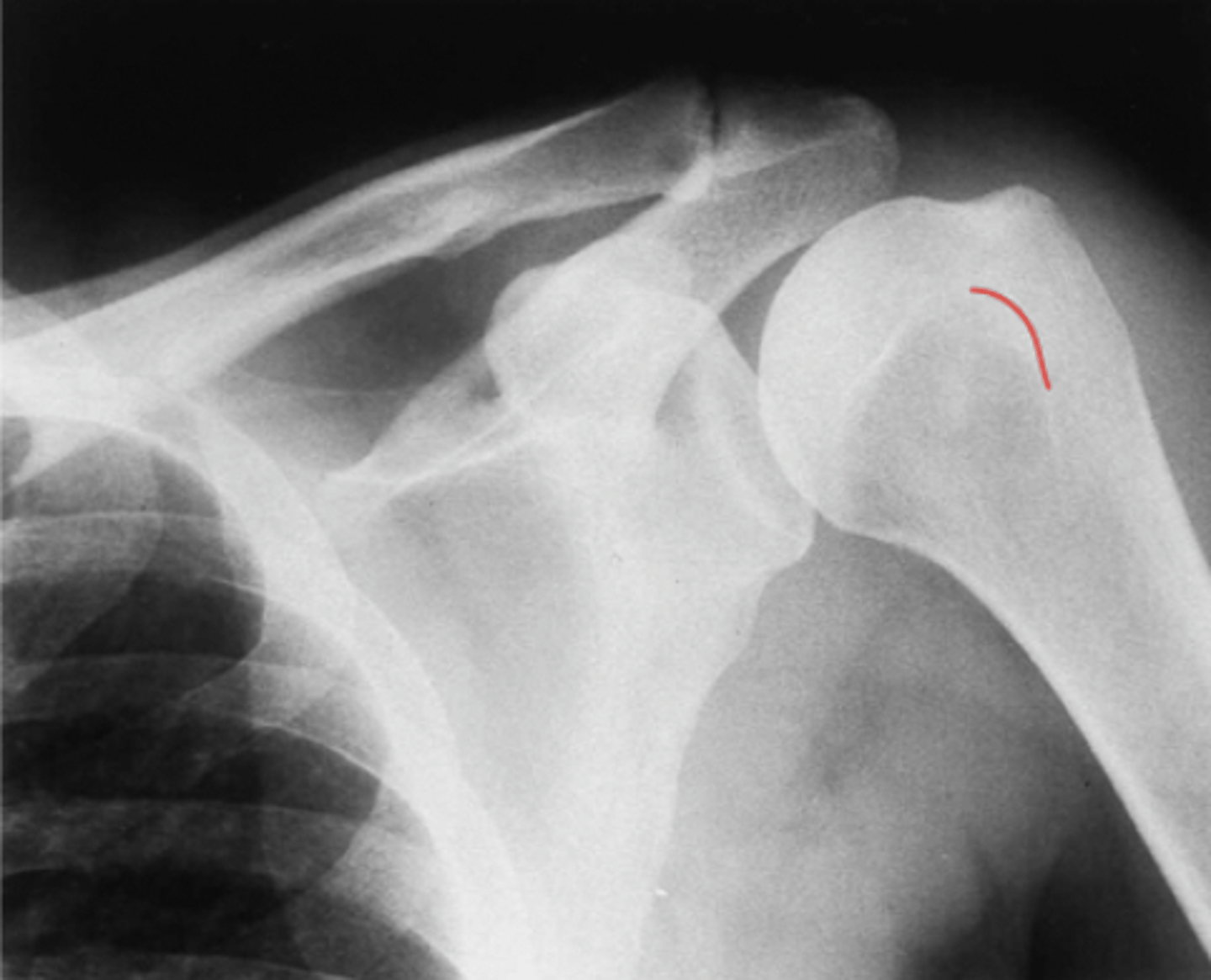 <p>What structure is highlighted?</p>