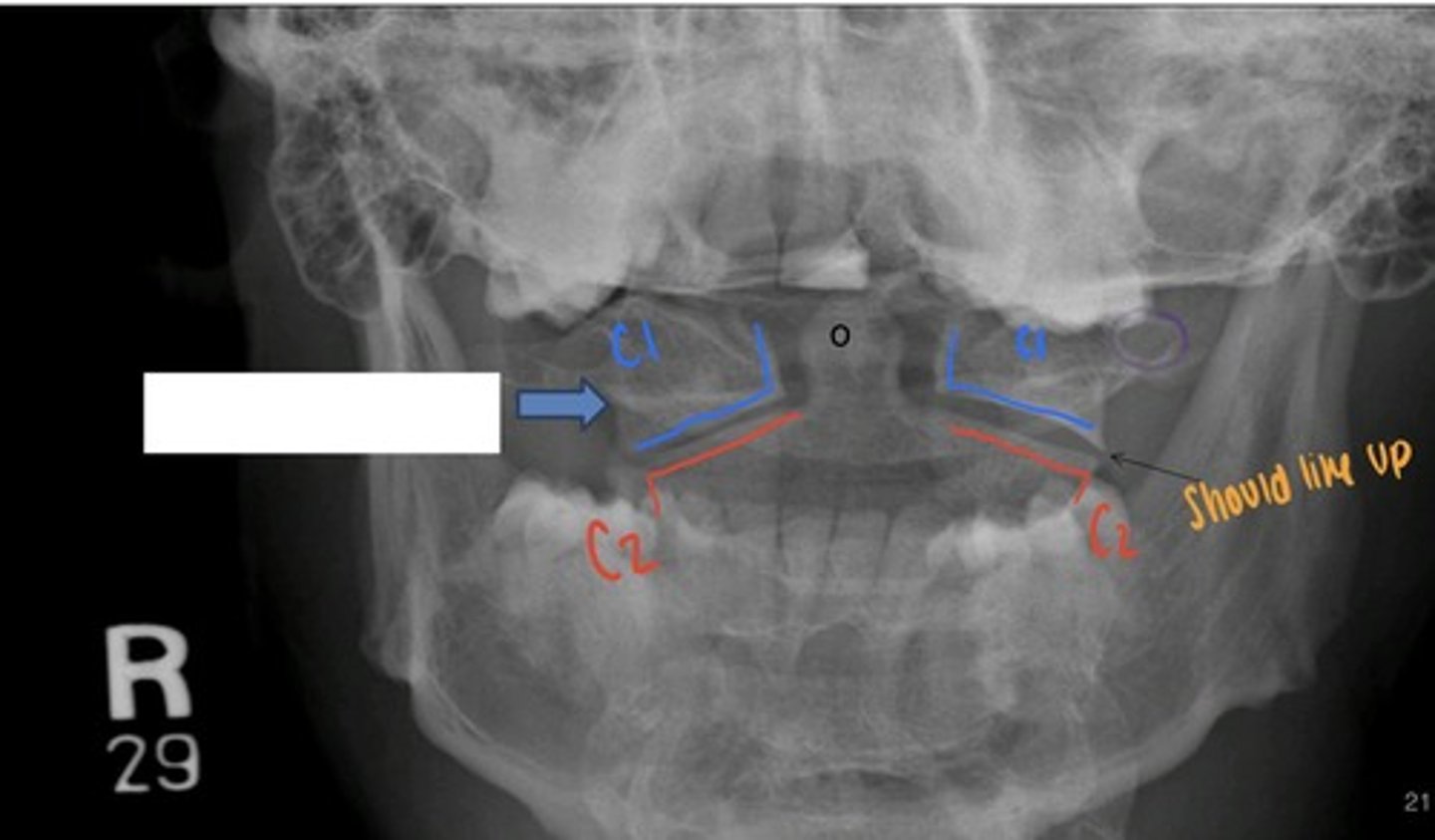 <p>what is the blue arrow pointing to?</p>
