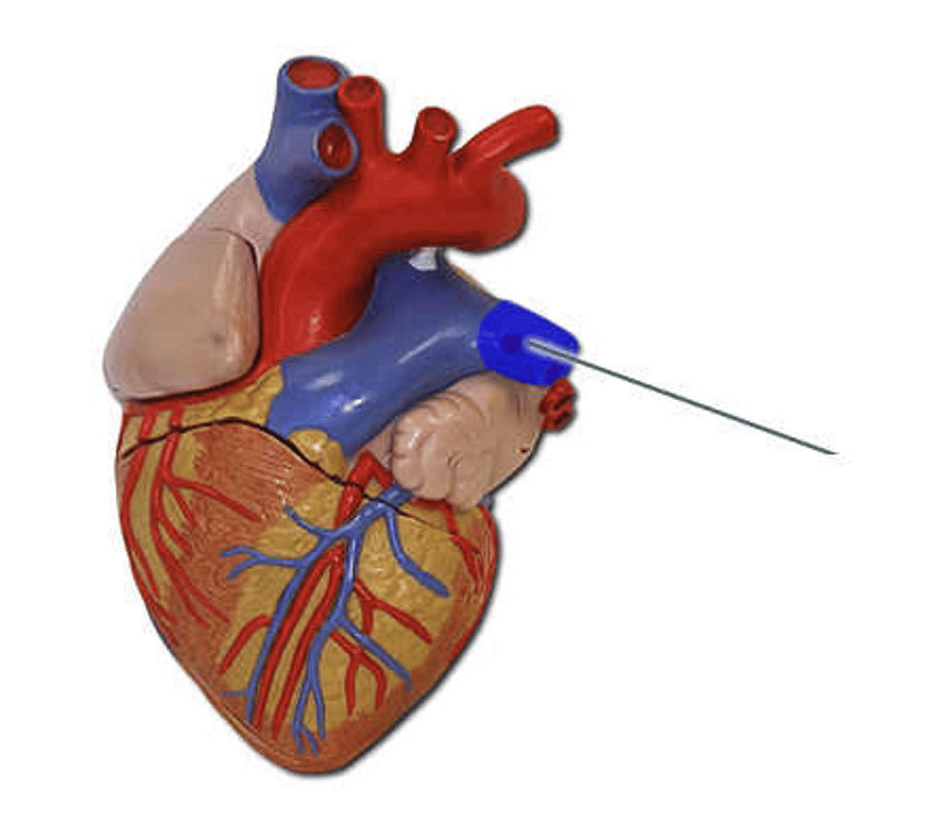 <p>Identify the highlighted structure.</p>