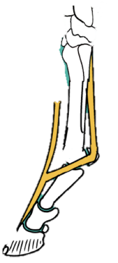 <p><strong>Origin -</strong> proximal MC3… runs palmar, fills entire space between the two splint bones</p><ul><li><p>BRANCHES in 2, attaching to the ABAXIAL aspect of the proximal sesamoids and wrapping around the metacarpo-phalangeal joint </p></li><li><p>Passes around the DORSAL aspect of the limb and fuses with the<strong> common digital extensor tendon </strong></p></li></ul><p></p><p><strong>Function </strong></p><ul><li><p>Acts like a sling; prevents prolonged hyperextension of the limb and returns the joint to a resting position </p></li><li><p>Relies on the STABILITY OF THE SESAMOIDS </p></li></ul><p></p>