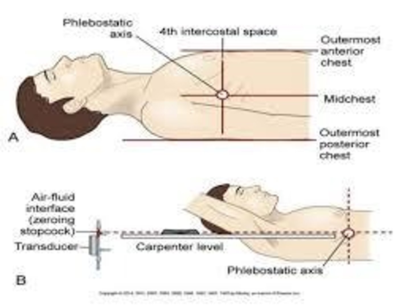 <p>It is the anatomical reference point for leveling the transducer to ensure accurate pressure readings.</p>