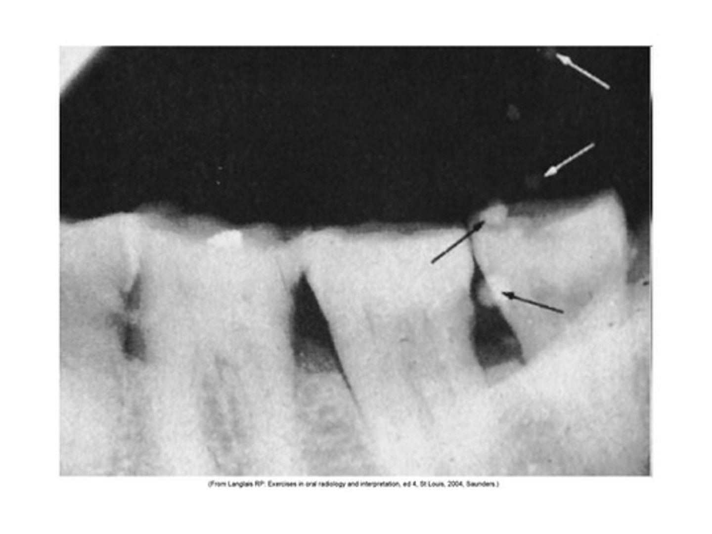 <p>occur when air is trapped on the film surface after the film is placed in the processing solution</p>