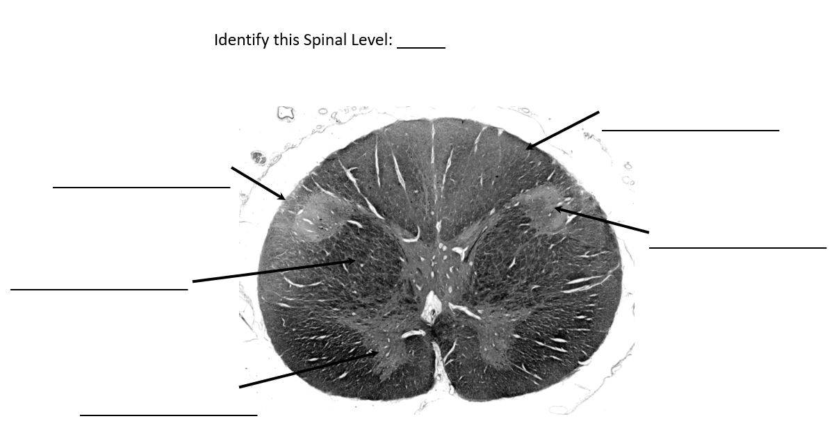 <p>identify this spinal level</p>