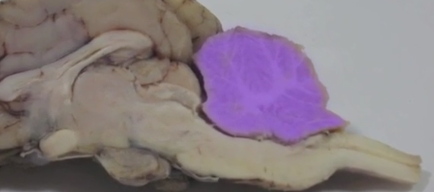 <p>Cerebellum </p>