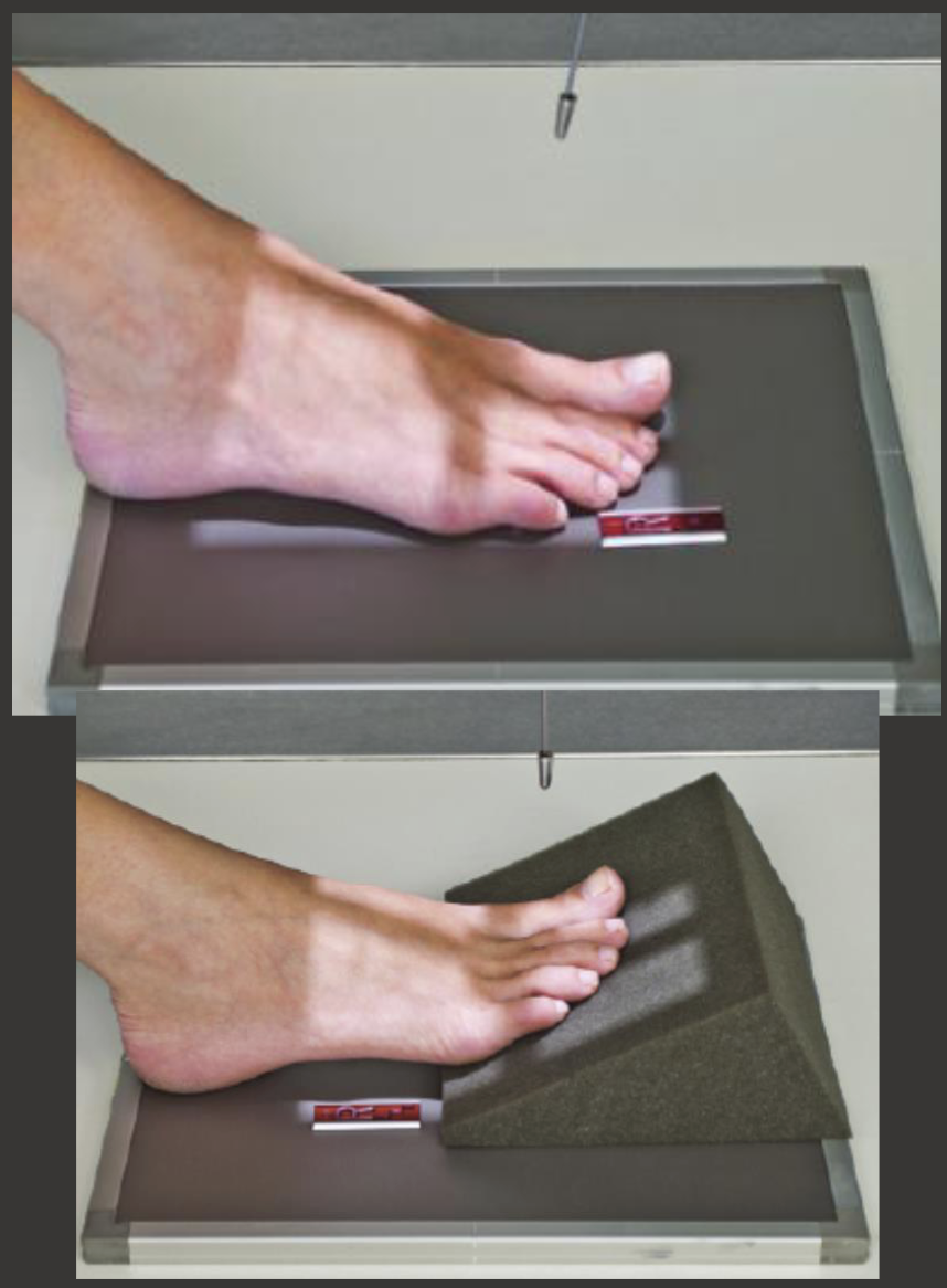 <p>Fine FS, 100cm</p><p>55kVp, 1mAs</p><p>Tube angle 10-15 degrees cephalic</p><p>CR: metatarsophalangeal joint&nbsp;</p>