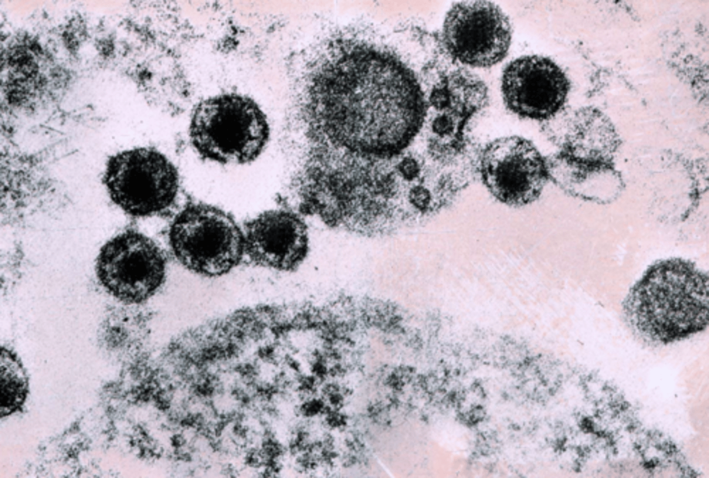 <p>Lentivirus</p><p>- familia Retroviridae</p><p>- ARN</p><p>- gran labilidad a las condiciones ambientales</p>