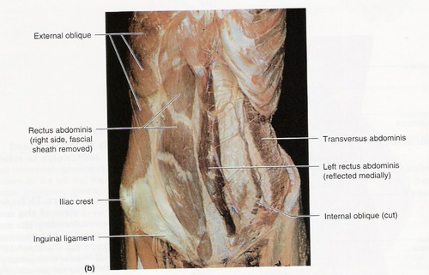 <p>Deeper lower side muscles, underneath external oblique; Action: Compresses abdomen, flexes and rotates trunk</p>