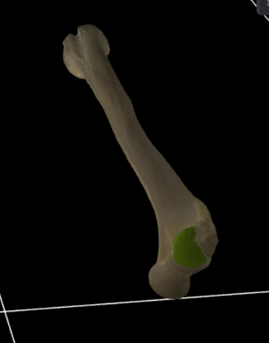<p>Meest laterale articulatievlak voor de radius, bolvormig.</p>