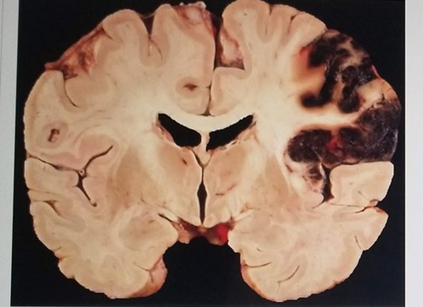 <p>parietal</p>