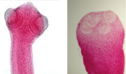 Scolex of what cestode?