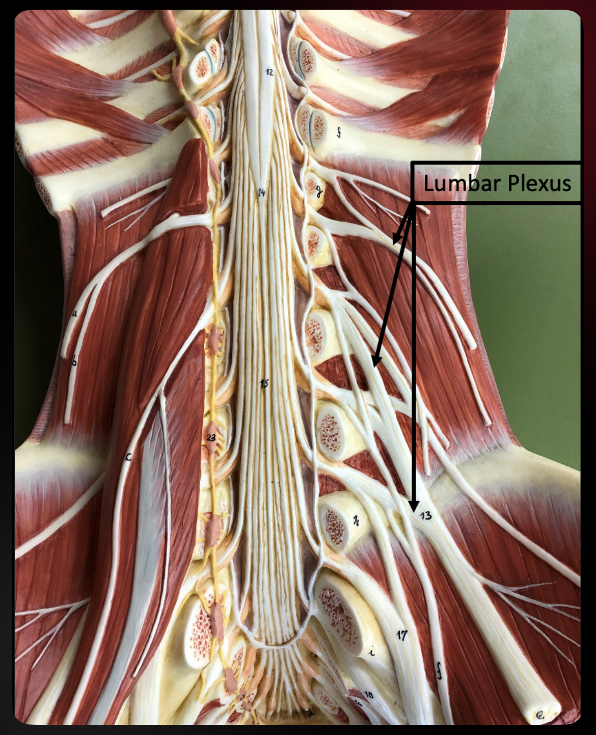 <p>Lumbar Plexus</p>