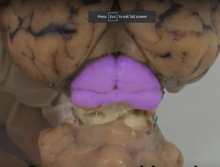 What part of the brain is this called?