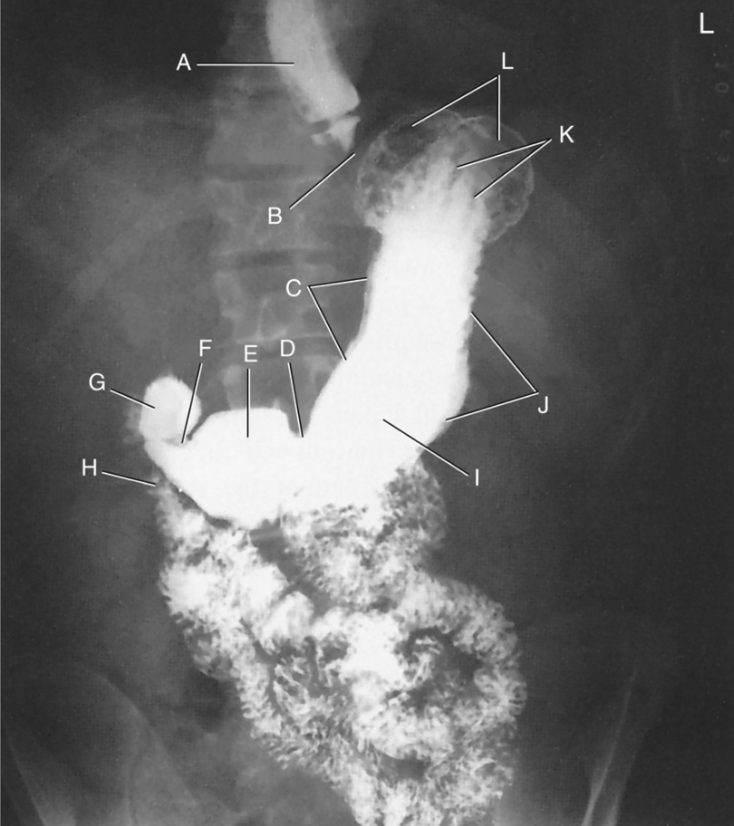 <p>What position is the patient in?</p>