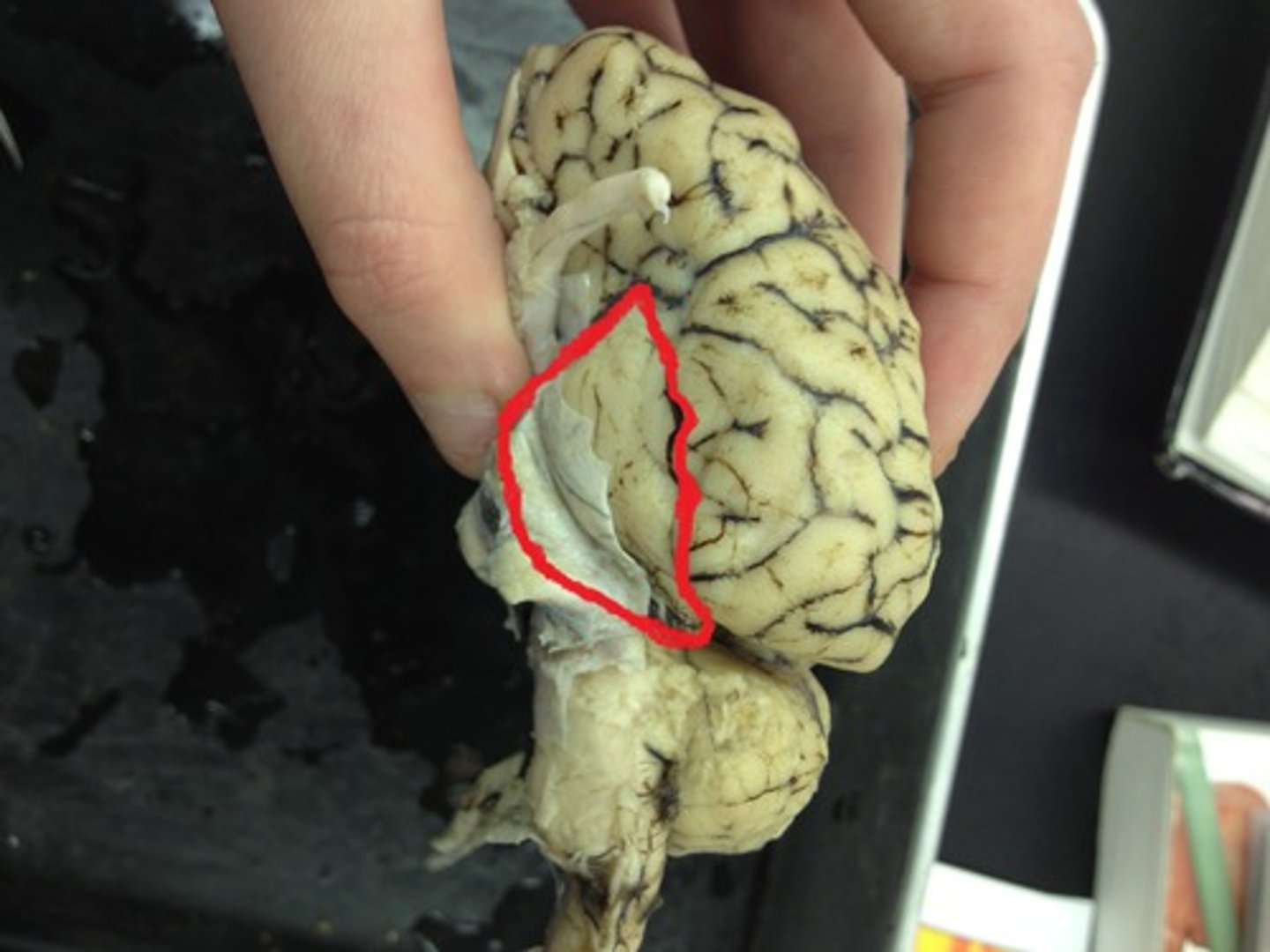<p>A lobe of the cerebrum responsible for hearing and language on the left. Smell, &amp; taste are also processed near these areas.</p>