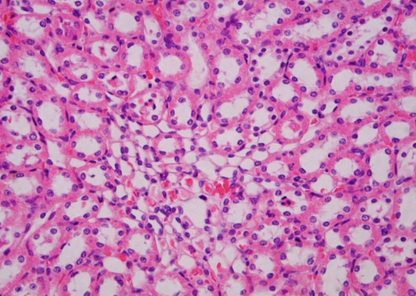 <p>what is this part of the nephron?</p>