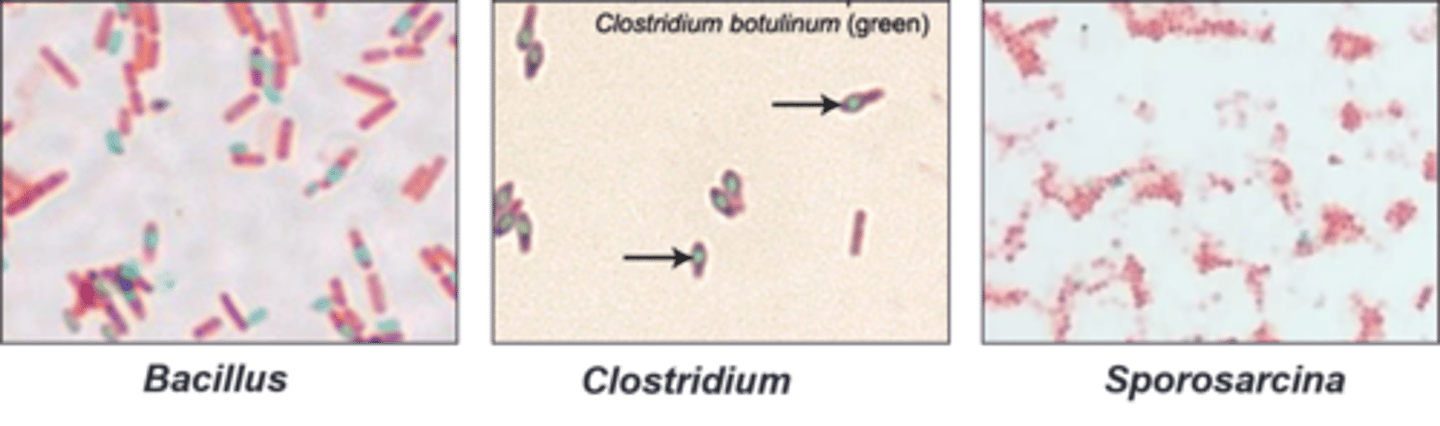 <p>Clostridium is</p>