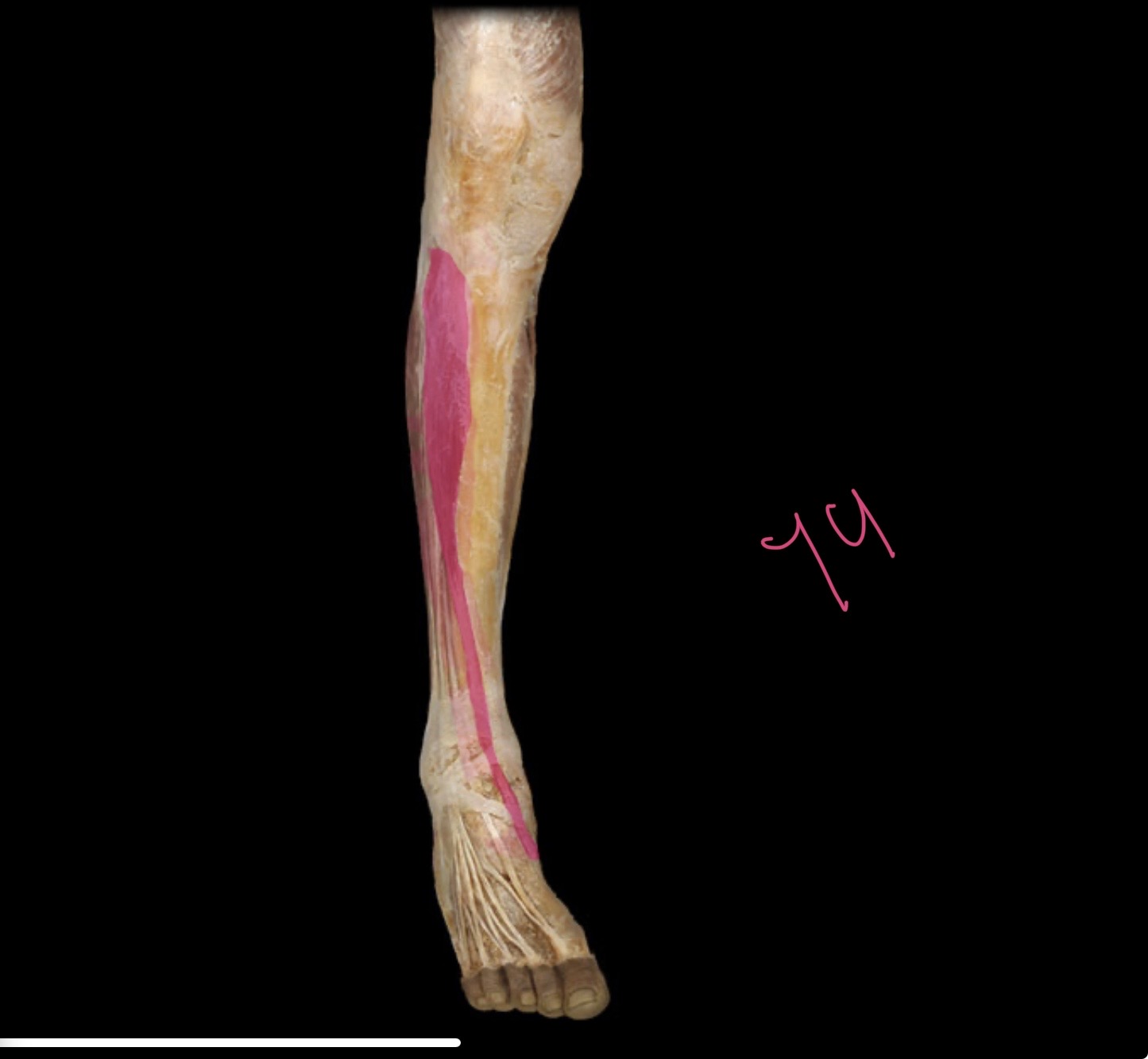 <p>Tibialis anterior</p>