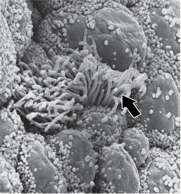 <p>Identify </p><p>Mention the type of microscope </p>