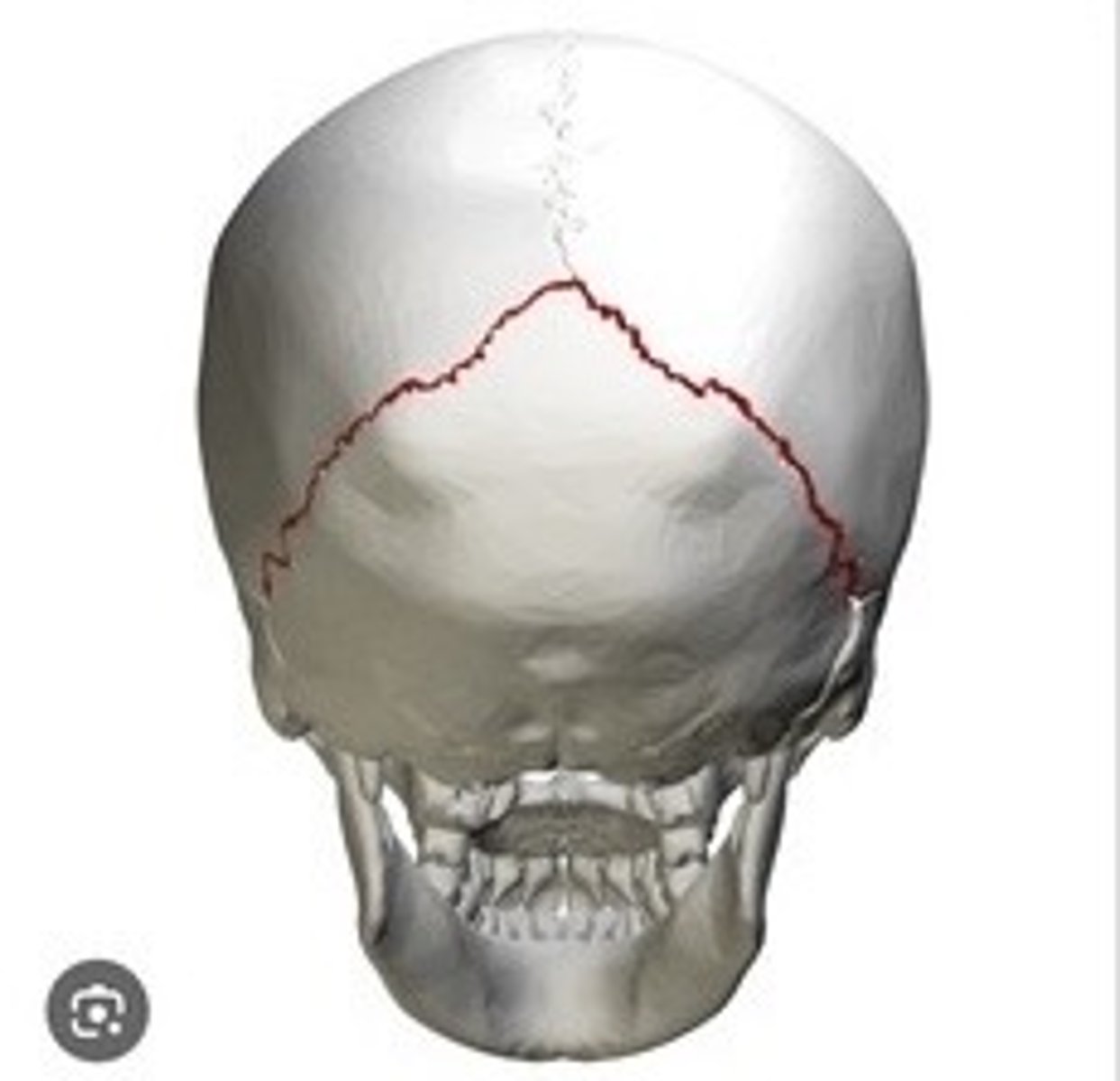 <p>Suture between parietal and occipital bones.</p>