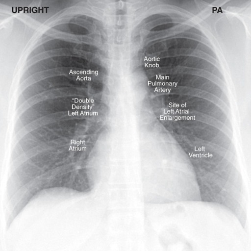<p>Cardiac Contours</p>