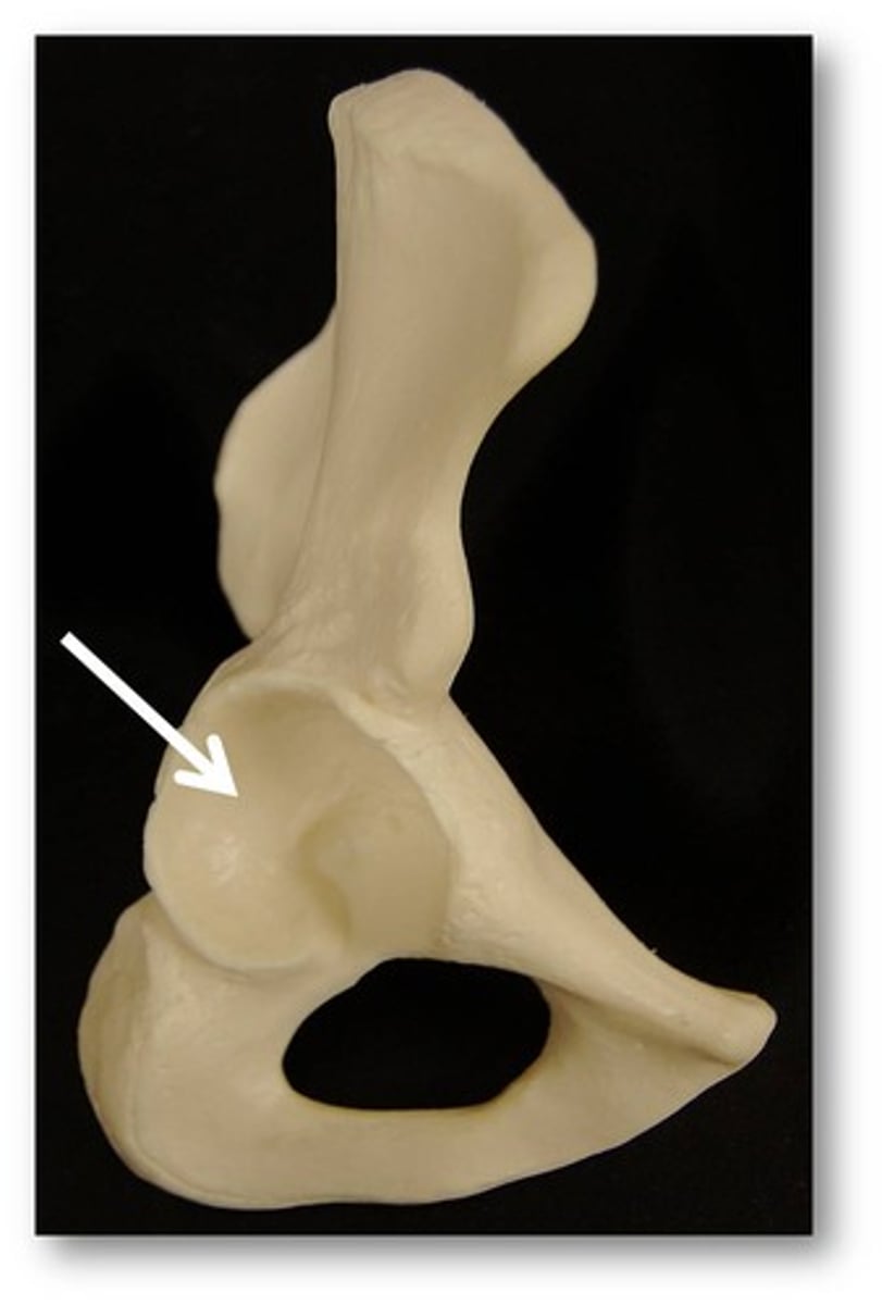 <p>hip socket</p>
