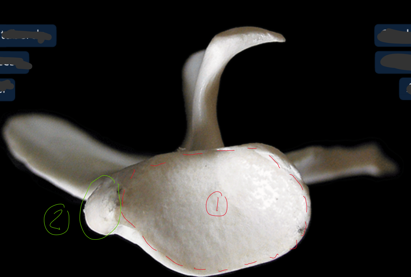 <p>label the ventral end of the scapula (this is looking from bottom to top)</p>