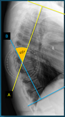 <p>Q what is the name of this measurement? and what is the average + range?</p>