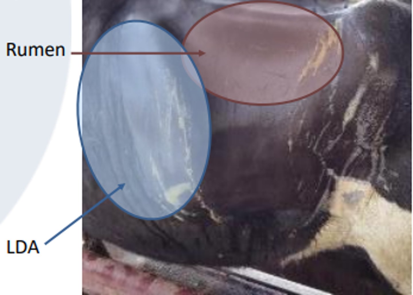 <p>history and signalment (dairy cow recently calved, back in the milk and not eating)</p><p>clinical exam: pings</p><p>LDA will have pings under the last 3 ribs</p><p>empty rumen with large gas cap</p><p>don't need to do ballottement for LDA (more so with RDA)</p>
