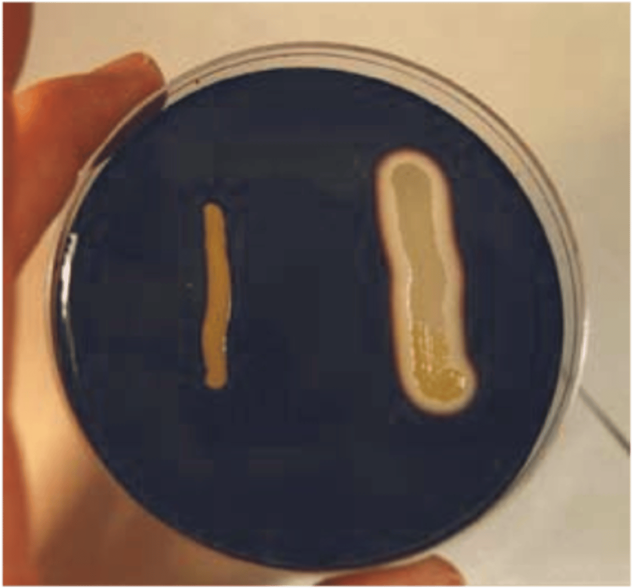 <p>1. starch</p><p>3. iodine</p><p>4. halo of clearing</p><p>5. no halo, all the starch is still present</p><p>6. differential</p>