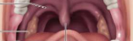 <p>Uvula</p>