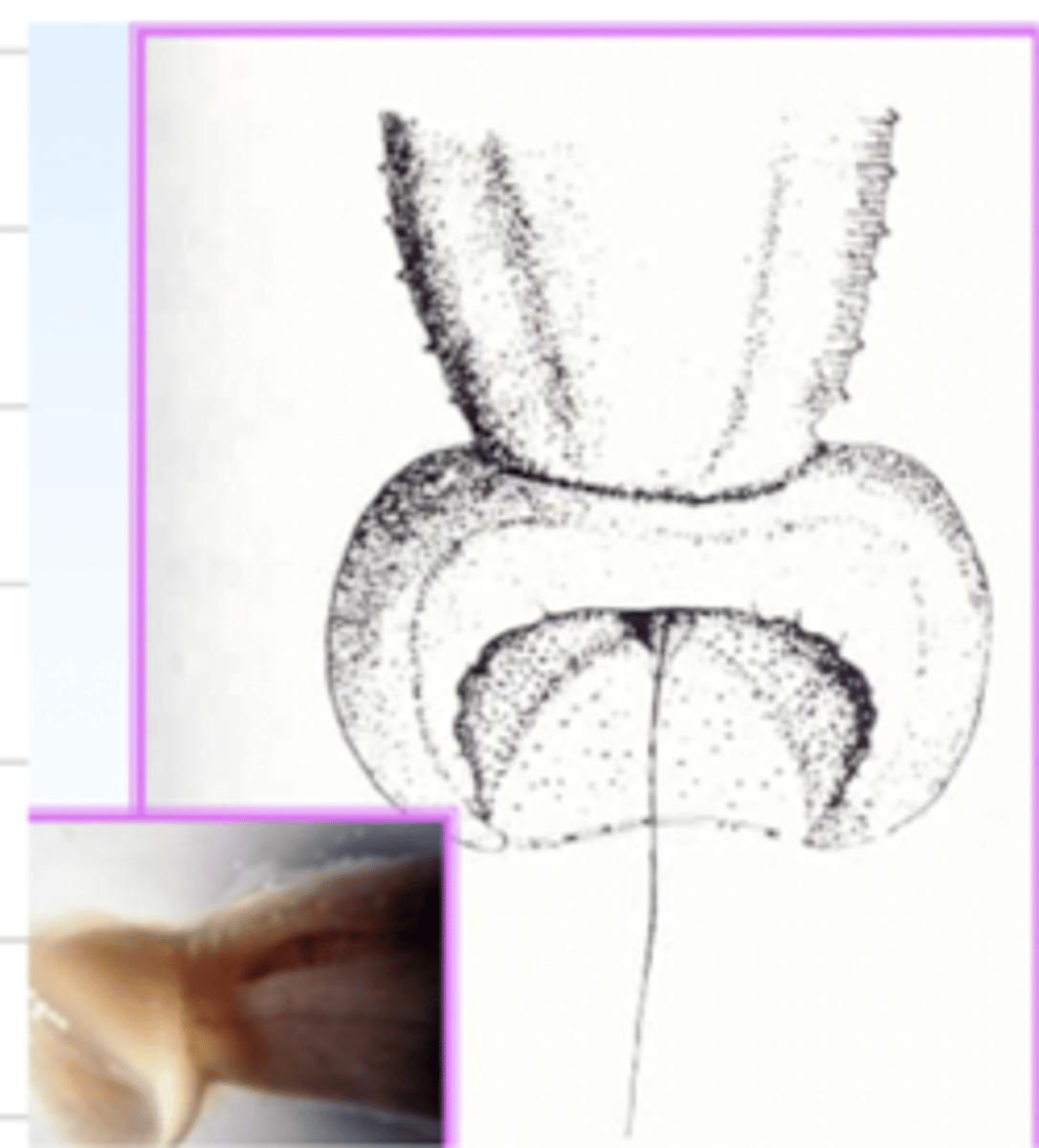 <p>this bell-shaped bursa and 1 spicule belongs to what species?</p>