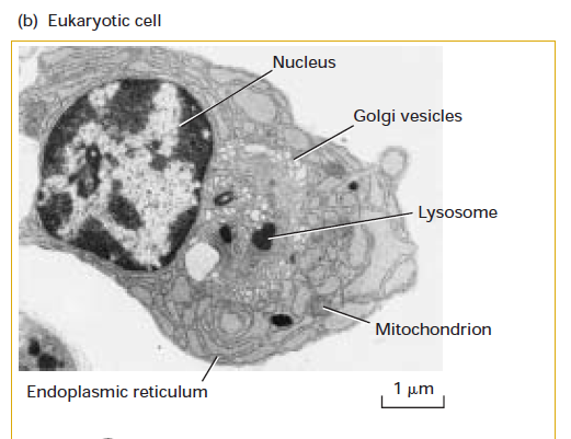 <p>Transmission Electron Micrograph of a plasma cell</p>